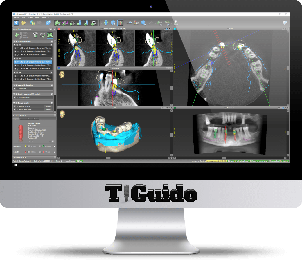 software coDiagnostiX